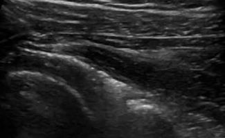 ydrodiatase pagomenou omou