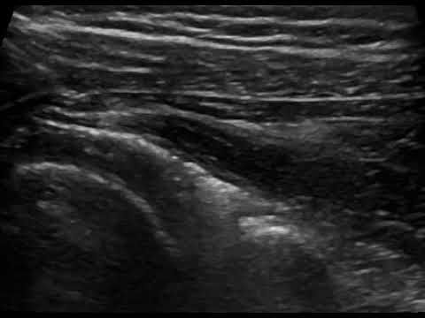 ydrodiatase pagomenou omou