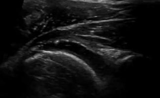 ydrodiatase pagomenou omou