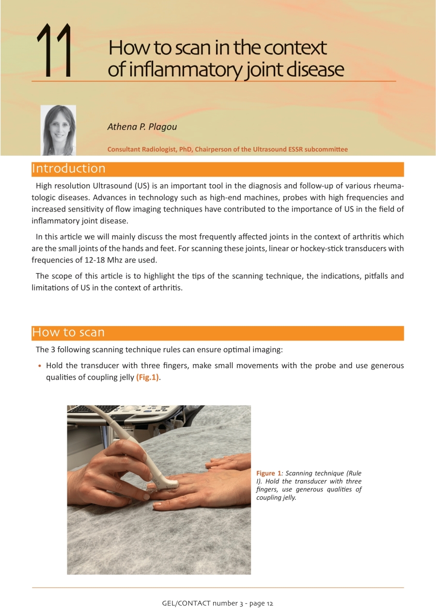 Ρευματολογικές Παθήσεις